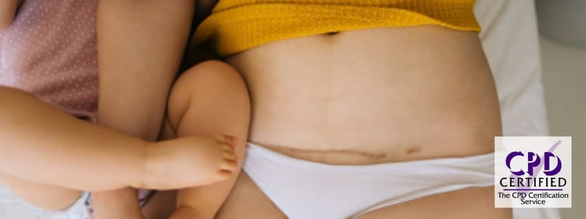 Mother with c-section scar and baby lying on a bed